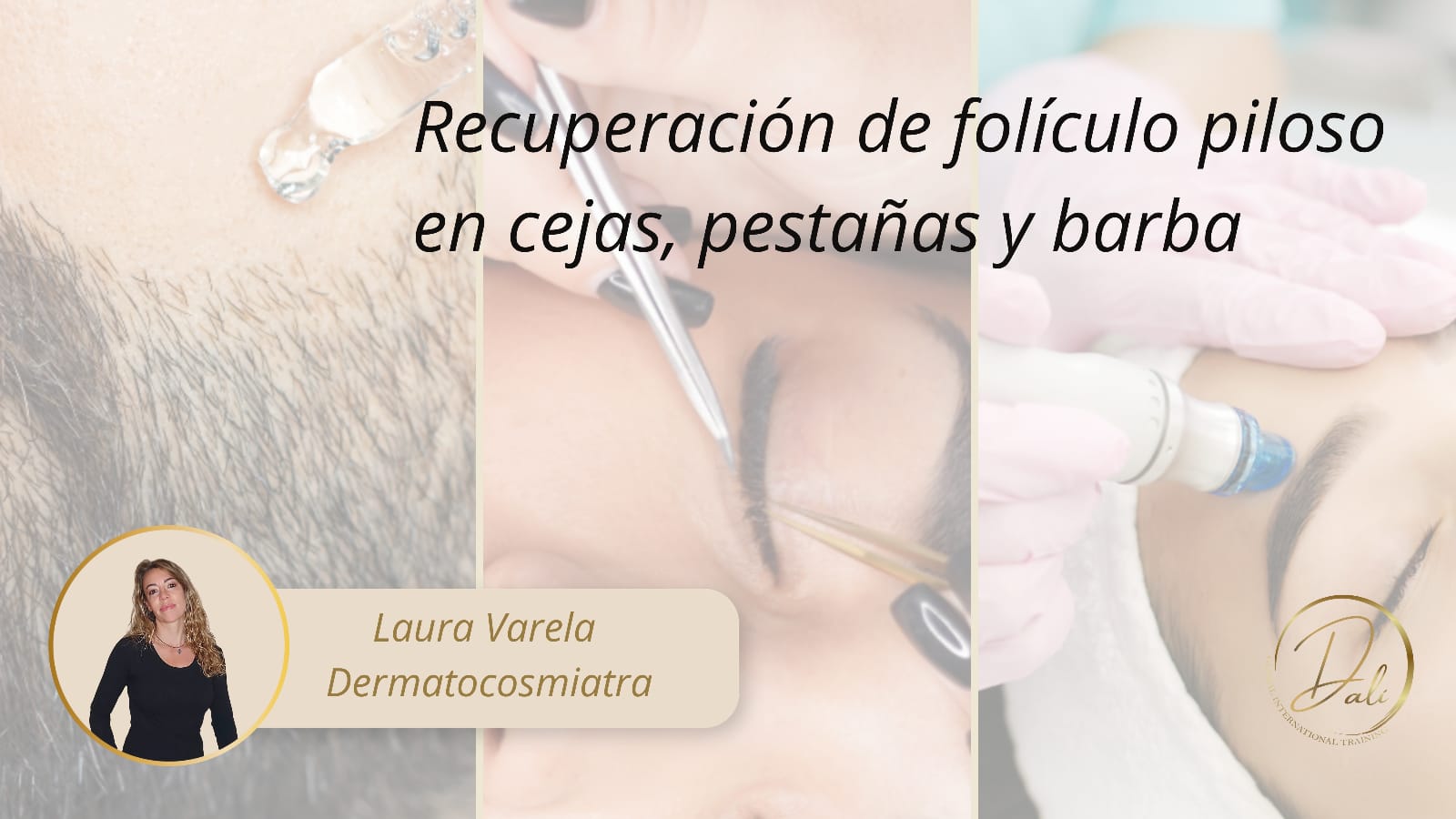 Recuperación de folículo piloso (cejas-pestañas-barba)